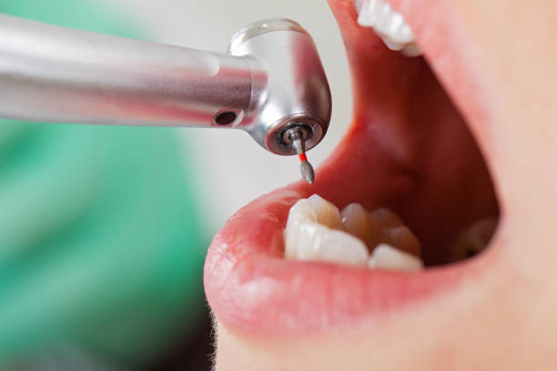 Best Emergency Root Canal Treatment in Lockport Heights, LA